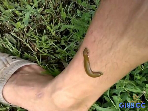 Mơ thấy đỉa bám vào chân cho thấy bạn đang gặp trở ngại trên con đường sự nghiệp