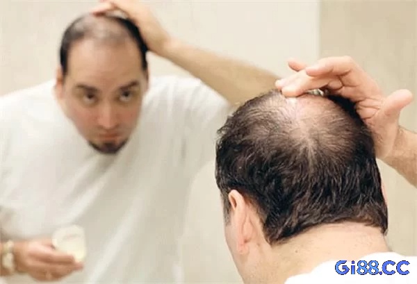 Giải mã giấc mơ rụng tóc chính là cơ hội cải vận