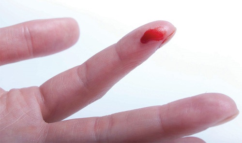 Chảy máu đánh con lô gì - Giải mã hiện tượng chảy máu