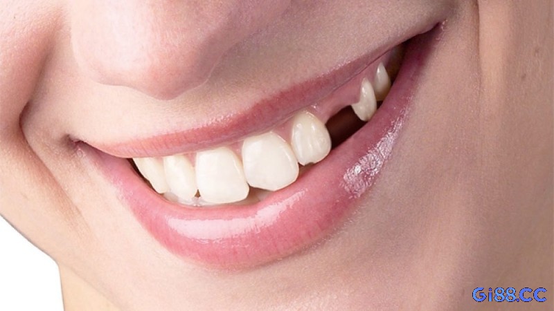Giấc mơ răng gãy tượng trưng mạnh mẽ cho sự mất kiểm soát và bất lực trong các giai đoạn chuyển biến cuộc sống.