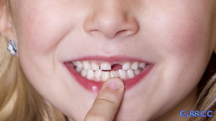 Giải mã giấc mơ bị gãy răng là lời cảnh báo từ tiềm thức về áp lực và căng thẳng bạn đang trải qua.